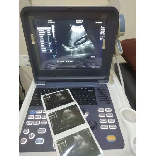 Portable 4D Cardiac Color Doppler Ultrasound Scanner