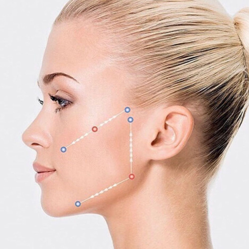 Botox For Hands Face Neck Lift Boobs Enlarge PLA Dermal Fillers Manufactory