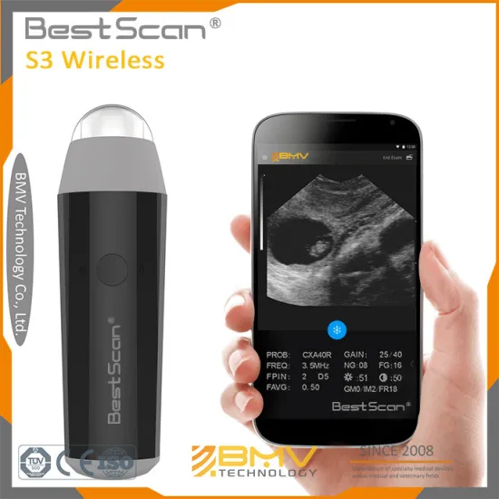 Milk Farm Wireless Ultrasound Scanner (S3)