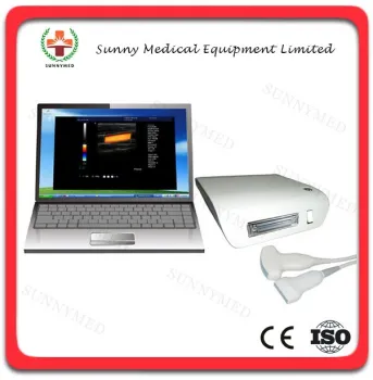 SY-A010 Medical Portable Cheap b ultrasound box price