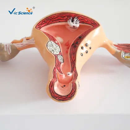 Pathological Uterine Anatomy Education Model