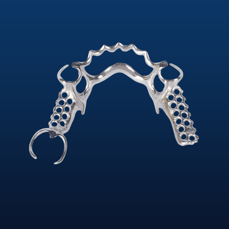 Cast partial,3D printed metal partial,Bego metal partial,cast metal framework,Vatalium Metal framework