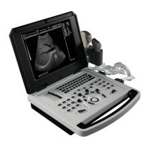 Li Battery Notebook B Ultrasound Scanner