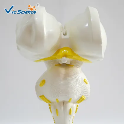 Brain stem amplification model