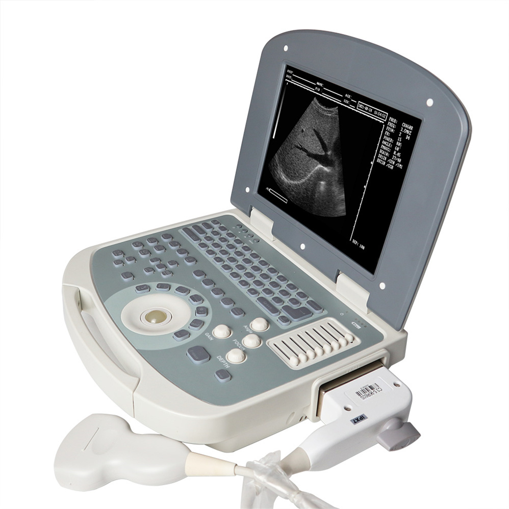 b/w laptop ultrasound machine for pregnancy