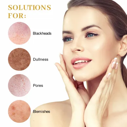 Bio Acne Treatment: Soil Cleansing Mud Facial Mask for Removing Blackheads