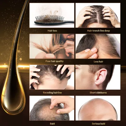 Hair Care & Styling Products: Anti-Loss Hair Growth Oil Serum & Regrowth Treatments