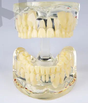 Standard Pediatric Dental Model for 7-Year-Old Children