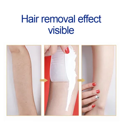 Aloe Vera Acne & Hair Removal Cream - Permanent Hair Removal for Women