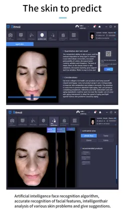 2023 Newest Digital Skin Scanner 3D Analyzer - Portable Magic Mirror Facial Skin Analyzer Machine