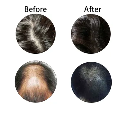Ginger Anti-Hair Loss Shampoo for Hair Care