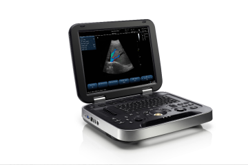 Color Doppler Diagnostic Ultrasound System