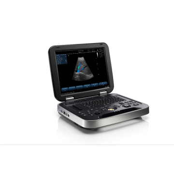 Renkli Doppler Tanısal Ultrason Sistemi