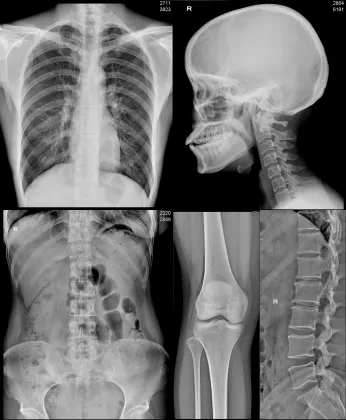 CT Scan Film for Fuji DI-HL Drypix Imaging Printer