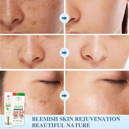 Aichun Beauty OEM Moisturizing Anti-Freckle Cream