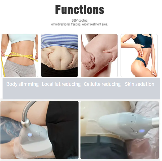 function of cryolipolysis machine