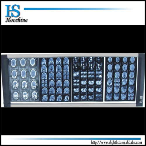 LED Backlit Negatoscope/X Ray Film Viewer