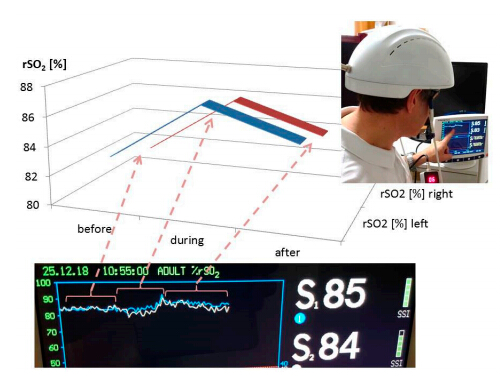 Improve memory boost brain function regulation machine