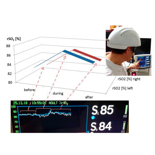 Infrared light therapy laser helmet Parkinson therapy device