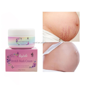 Best Organic Skin Care: Anti-Cellulite & Stretch Mark Removal Creams - Wholesale Deals
