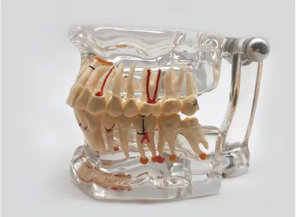 Orthodontic and Dental Pathological Teeth Model Restoration Study in Medical Science