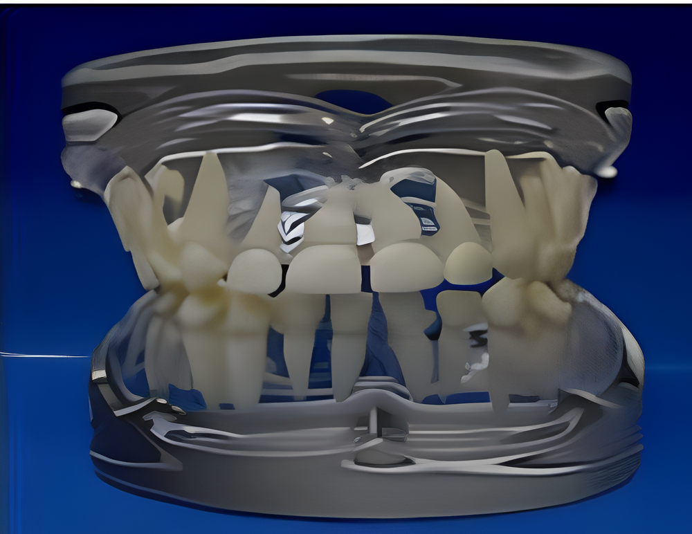 Modelo de desarrollo de dientes de leche transparente