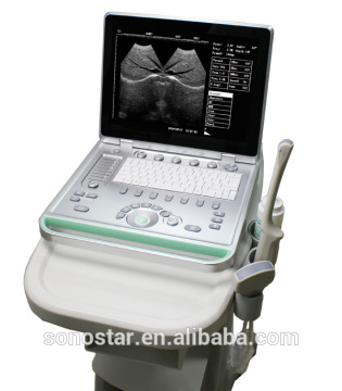 SS-7 Laptop Ultrasound Scanner(ultrasonic,black white,Imaging System)