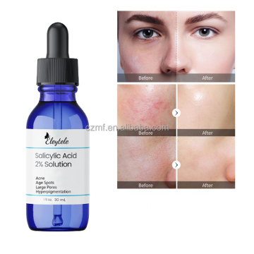 Private Label Azelaic Acid Clear Skin Serum with Salicylic Acid 2% for Exfoliation and Organic Skincare