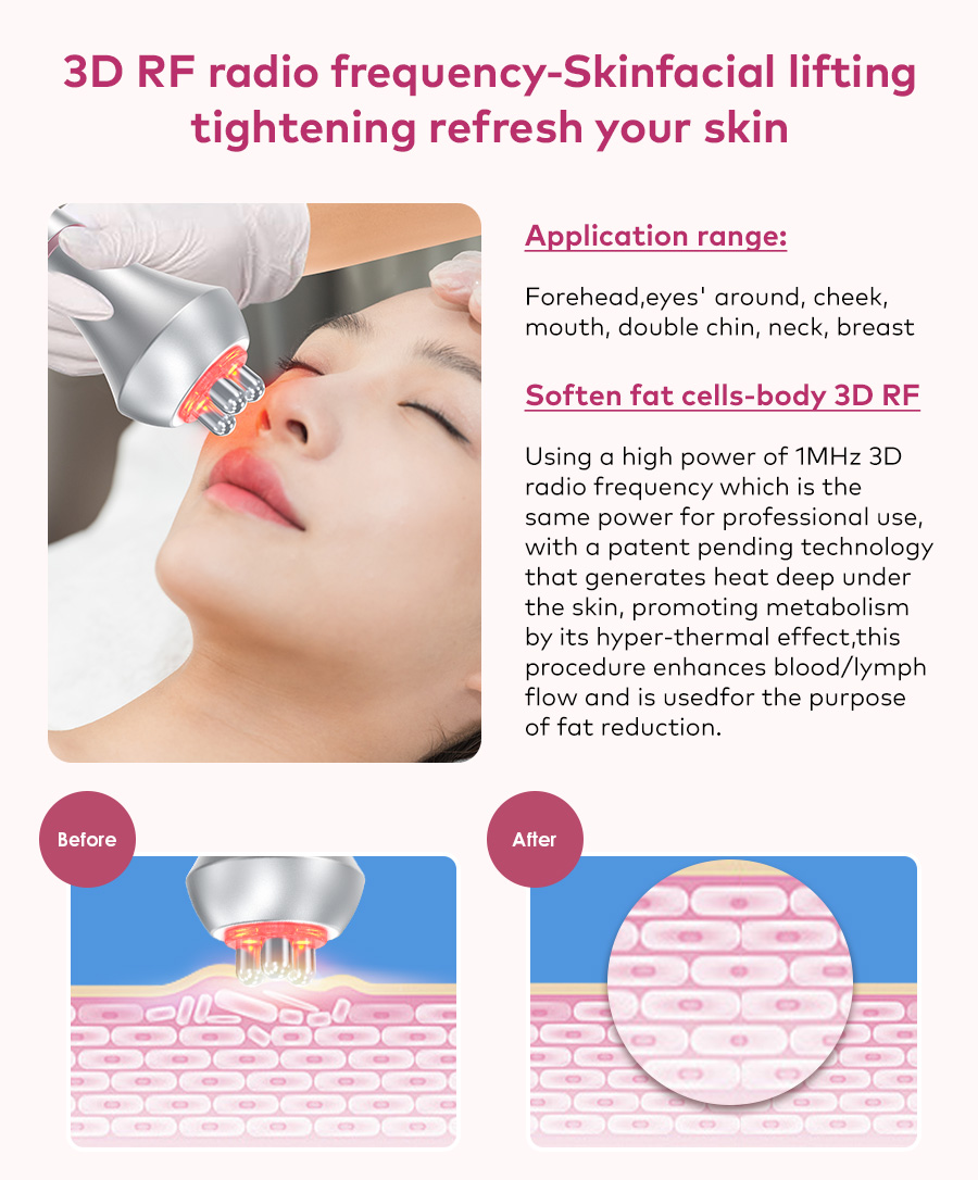 radiofrequency facial