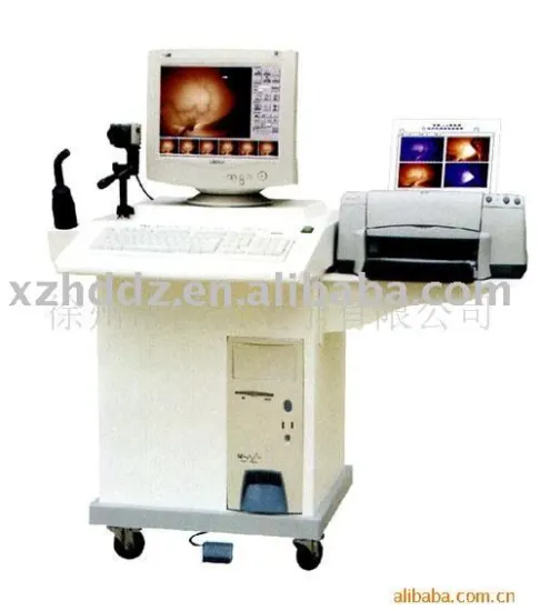 Infrared Mammary Diagnostic Equipment