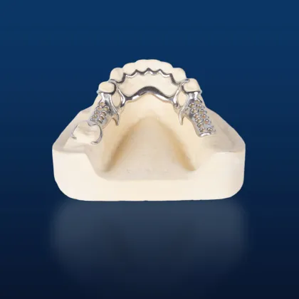Bego Metal Partial Denture