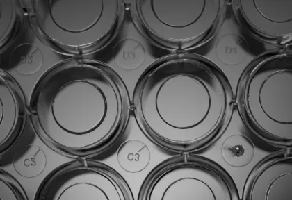 20mm glass bottom cell culture dish