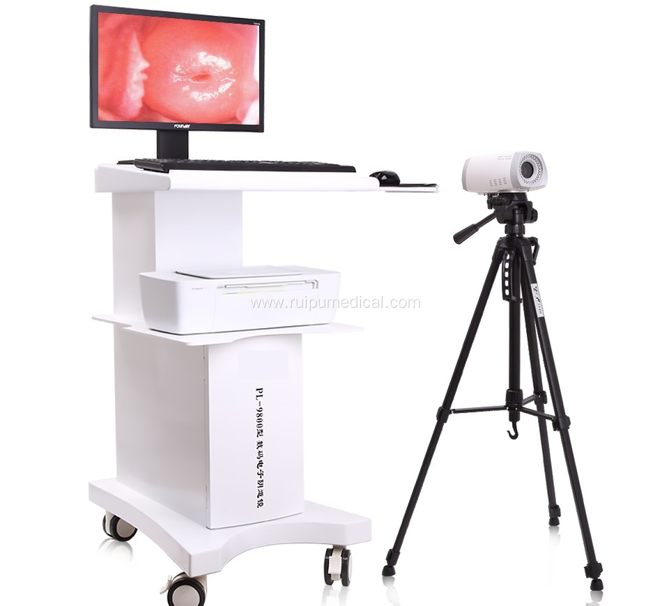 Medical Digital Portable Video Colposcope for Gynecology