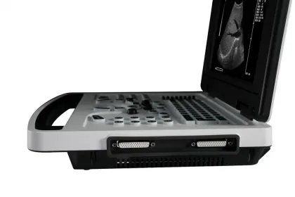 B/W ultrasound machine Notebook B Ultrasound Scanner