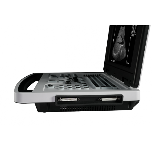 Black And White Ultrasound Scanner B/W ultrasound machine Notebook B Ultrasound Scanner Factory