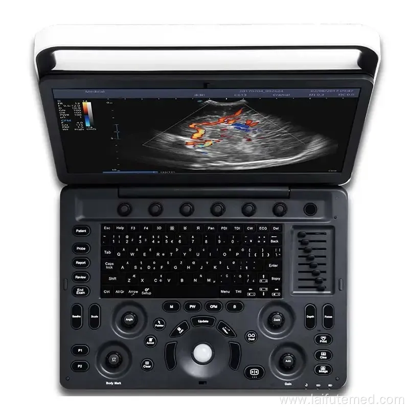 Sonoscape E1 Portable Animal Ultrasound