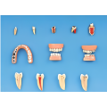 Modelo de enfermedades dentales (como herramienta educativa)