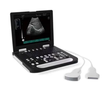Full-digital Laptop Ultrasound Scanner