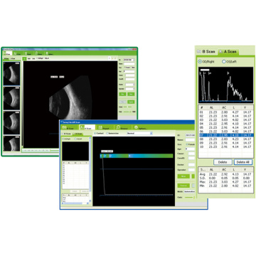 Ophthalmic Scanner Box support