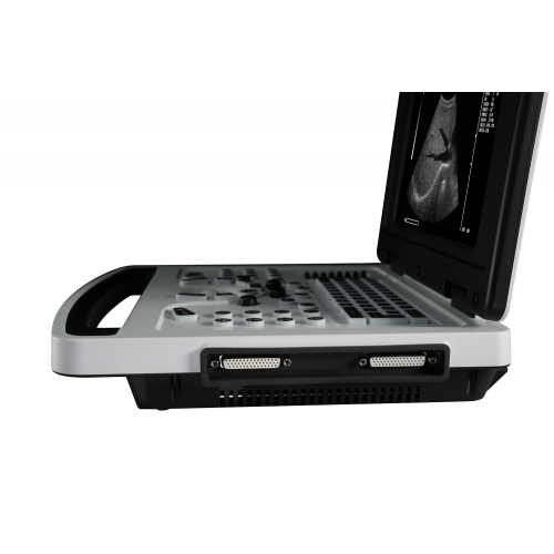 Notebook Black &white Ultrasound Scanner