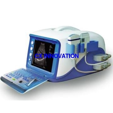 portable ultrasound scanner ultrasonic equpment