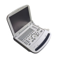 Laptop -Bauchfarbe Doppler Ultraschallmaschine