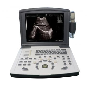 Scanner portátil de ultrassom preto e branco (bateria)