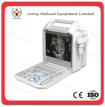 SY-A026 Portable usg medical ultrasound doppler color b ultrasound scanner