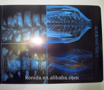 veterinary equipment medical equipments camera xray films
