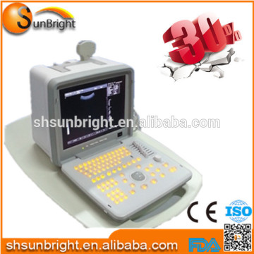 Portable ultrasound machines price for Middle East Sun-806X