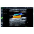 R60 3.5MHz convex probe color equine ultrasound
