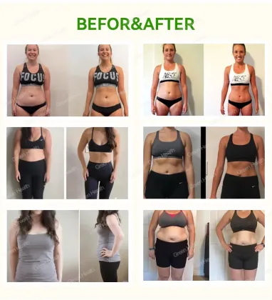OEM/ODM Appetite Suppressant Saffron Weight Loss Capsules