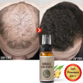 New 30/50ml Hair Growth Spray Ginger Essence Spray Effective Extract Anti Hair Loss Nourish Roots Prevent Hair Loss Grow Hair