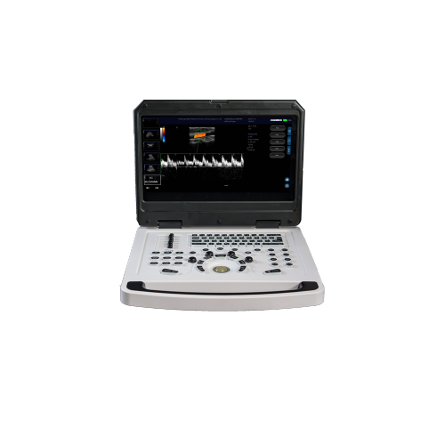 Full digital color doppler machine system image